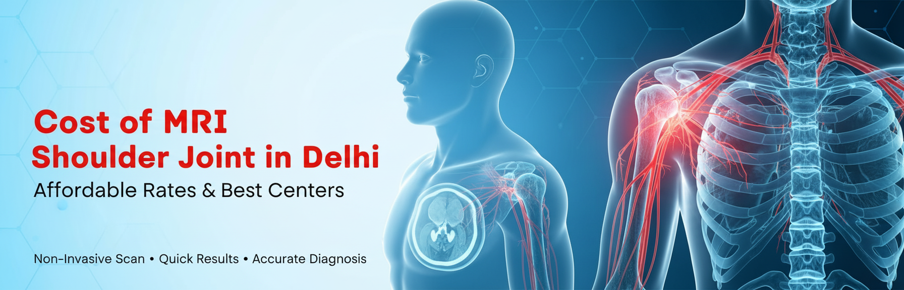 Cost of MRI Shoulder Joint in Delhi